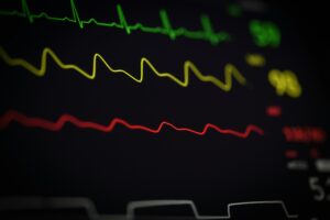 Health metrics displayed on a heart monitor